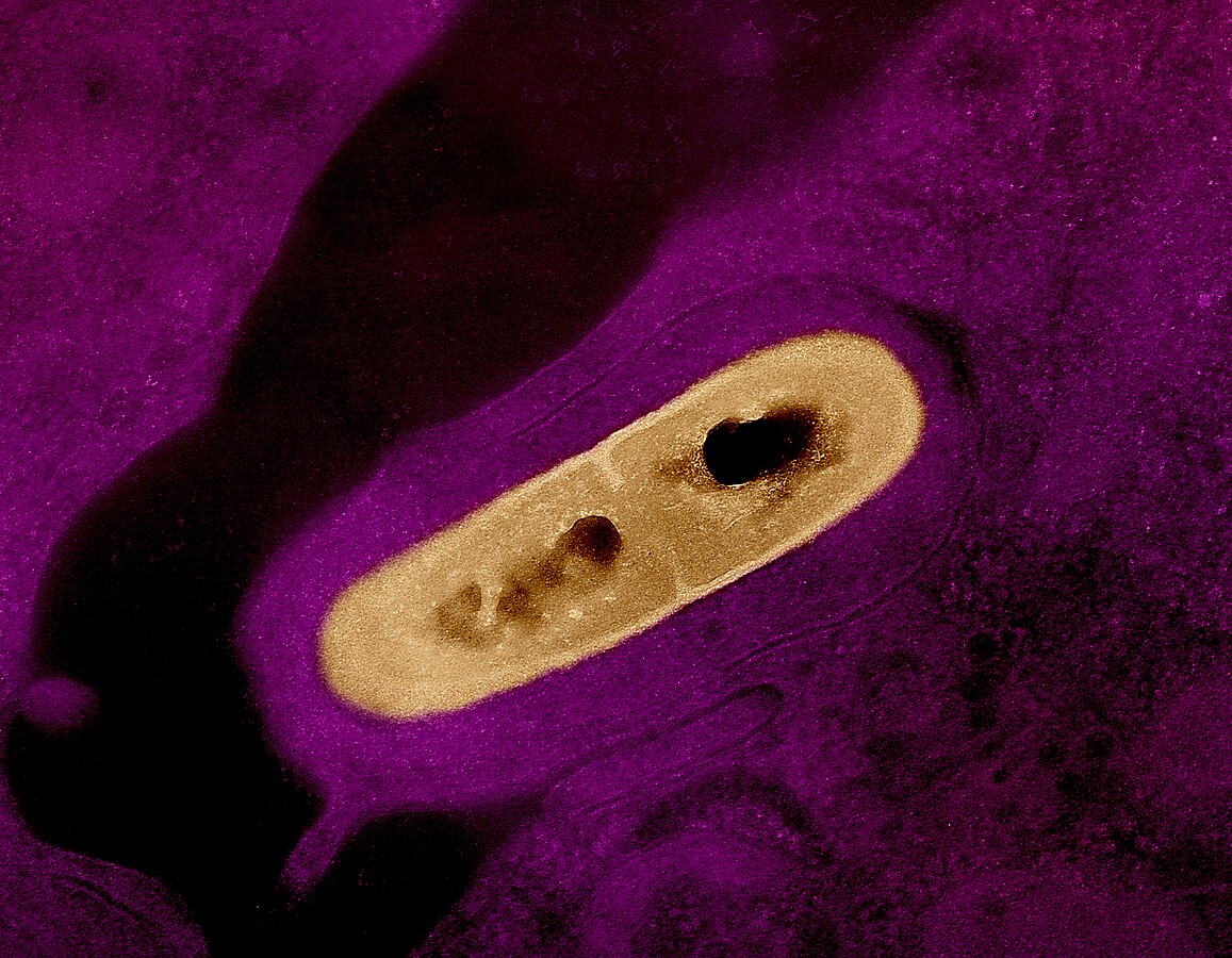 Imagen ampliada de la bacteria que causa la listeriosis, que experimentó un aumento de casos, según informó la Unión Europea. Foto: Wikipedia.