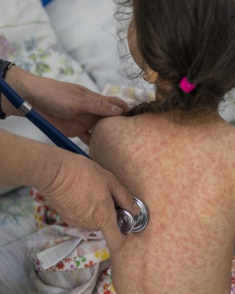 Según los expertos de la AEP si las coberturas no superan el 95 %, quedan nichos que los patógenos del sarampión y la tosferina pueden aprovechar. Foto: OMS.