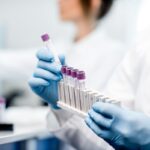 El Hospital Quirónsalud Córdoba incorpora el análisis de sangre para la detección precoz del Alzhéimer en personas con síntomas. Foto: prensa Quirónsalud.