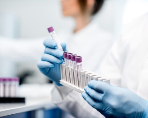 El Hospital Quirónsalud Córdoba incorpora el análisis de sangre para la detección precoz del Alzhéimer en personas con síntomas. Foto: prensa Quirónsalud.
