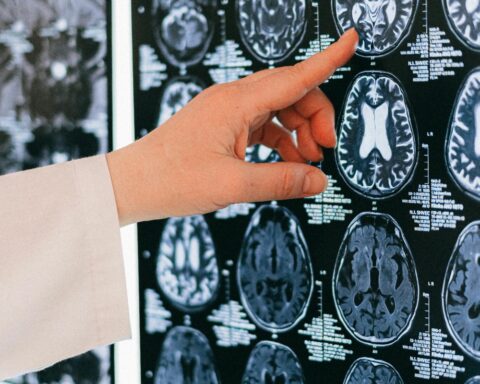 La UPC participa de una investigación sobre el funcionamiento del cerebro.