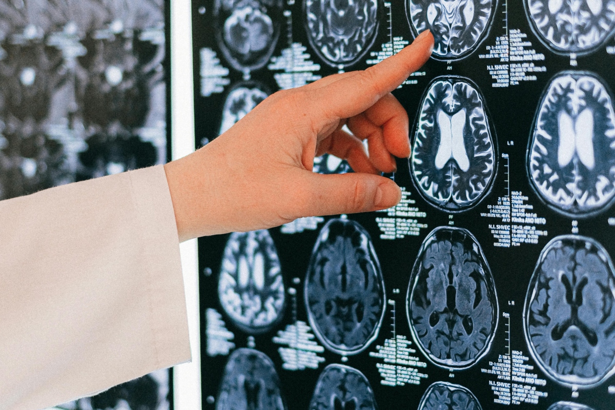 La UPC participa de una investigación sobre el funcionamiento del cerebro.