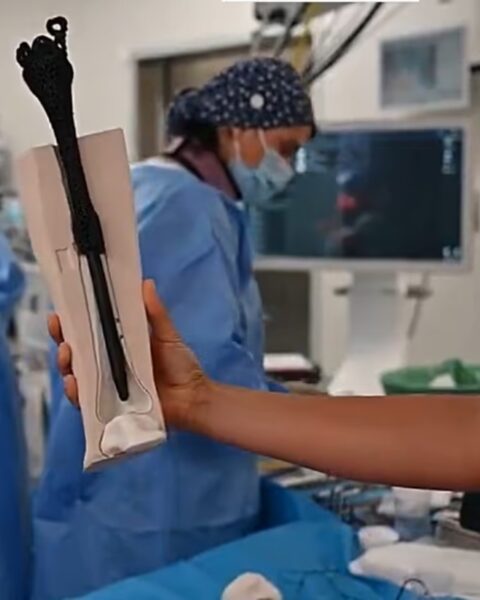 La próitesis ósea personalizada y el equipo que la implantado.