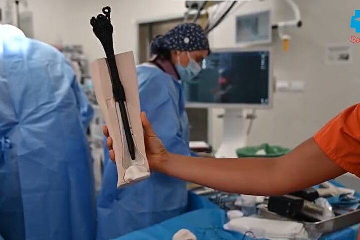 La próitesis ósea personalizada y el equipo que la implantado.